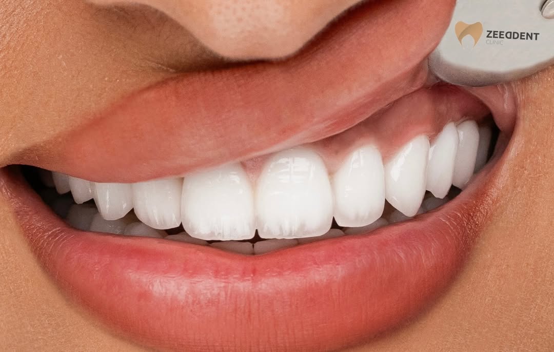 Happy patient result