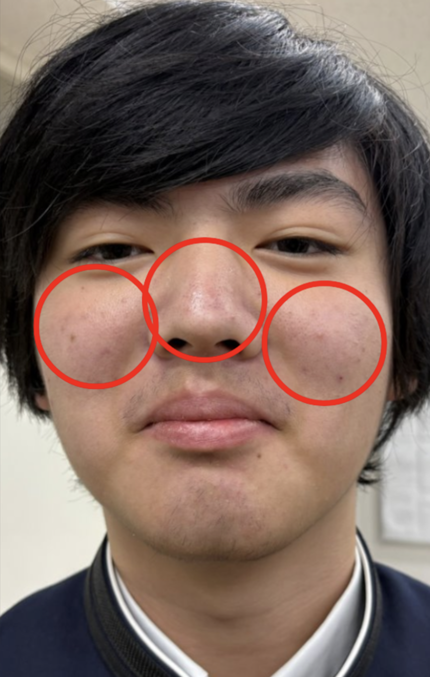 Before（イメージ）