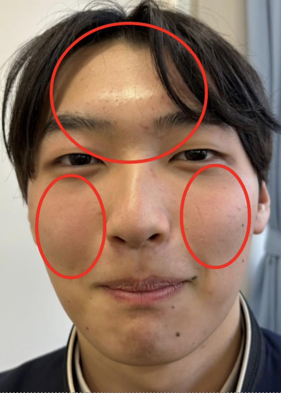 Before（イメージ）