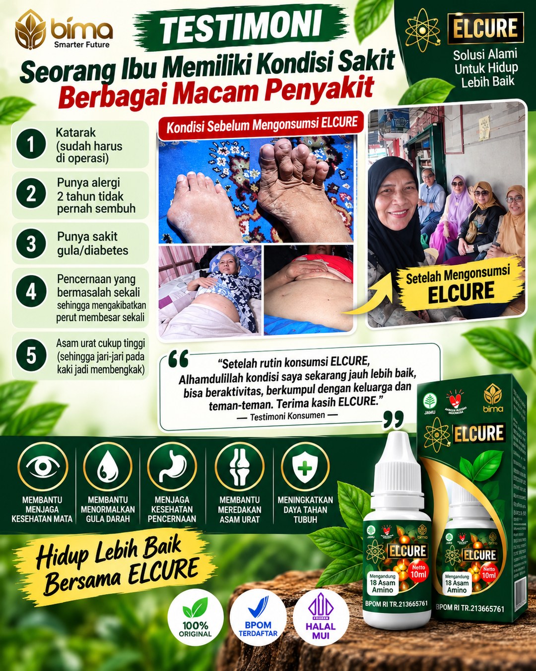Testimoni pelanggan Elcure 1