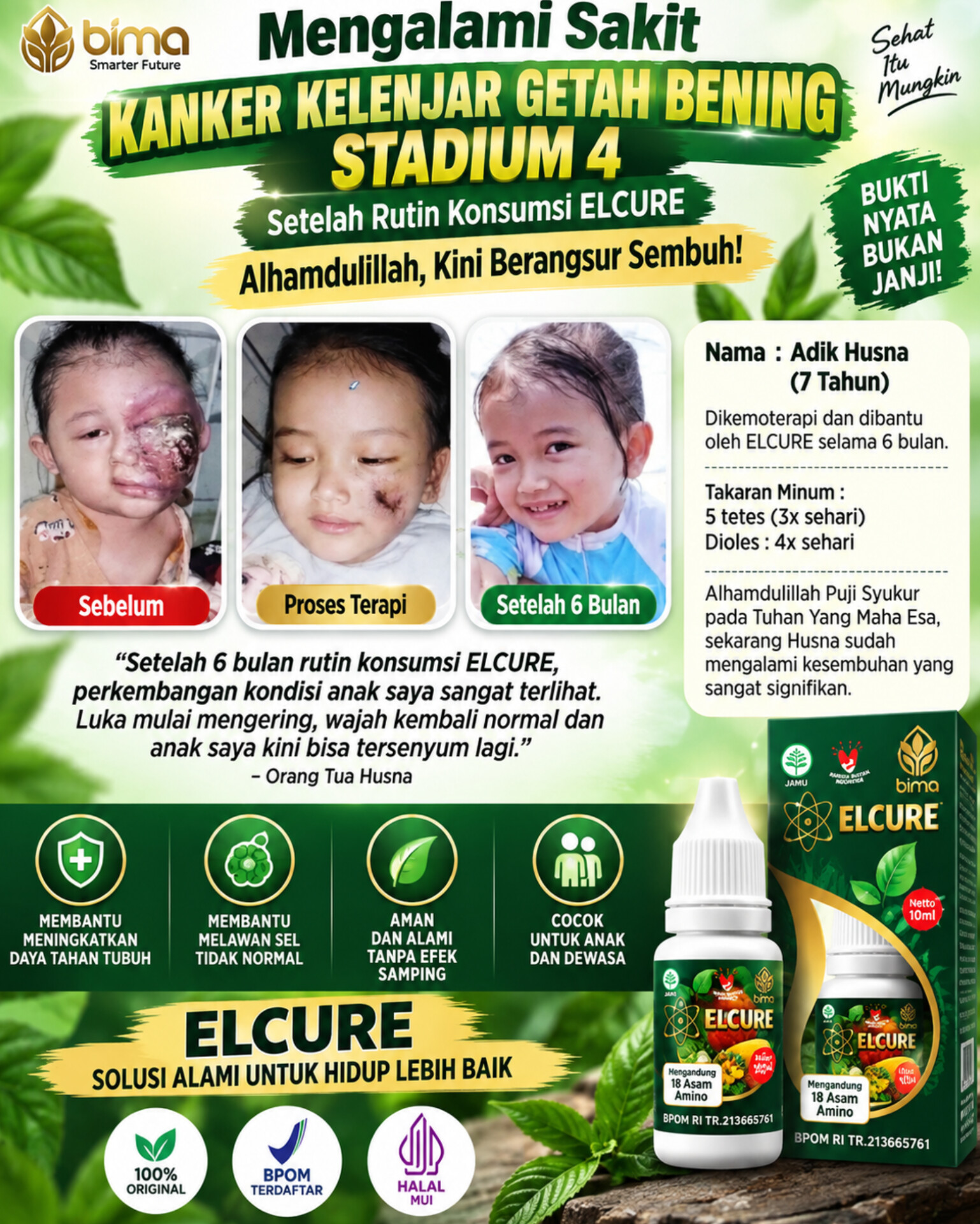 Testimoni pelanggan Elcure 6